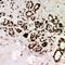 VICKZ family member 2 antibody, LS-C668311, Lifespan Biosciences, Immunohistochemistry paraffin image 