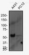 Keratin 5 antibody, NBP2-61931, Novus Biologicals, Western Blot image 