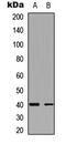 Potassium Two Pore Domain Channel Subfamily K Member 1 antibody, abx121659, Abbexa, Western Blot image 