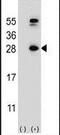 Dihydrofolate Reductase antibody, PA5-14267, Invitrogen Antibodies, Western Blot image 