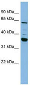Cytochrome P450 Family 3 Subfamily A Member 7 antibody, TA346220, Origene, Western Blot image 
