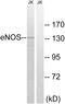 Nitric Oxide Synthase 3 antibody, LS-C118105, Lifespan Biosciences, Western Blot image 