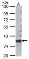 Src kinase-associated phosphoprotein 2 antibody, LS-C185798, Lifespan Biosciences, Western Blot image 