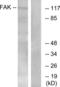 Protein Tyrosine Kinase 2 antibody, LS-C118115, Lifespan Biosciences, Western Blot image 