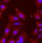 Tripeptidyl Peptidase 2 antibody, FNab08895, FineTest, Immunofluorescence image 