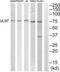 Cytomegalovirus UL97 antibody, PA5-39565, Invitrogen Antibodies, Western Blot image 