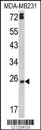 Lymphotoxin Alpha antibody, 63-494, ProSci, Western Blot image 