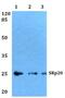 Serine And Arginine Rich Splicing Factor 3 antibody, A03127-1, Boster Biological Technology, Western Blot image 