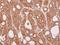 Centrosomal Protein 57 antibody, GTX115931, GeneTex, Immunohistochemistry paraffin image 