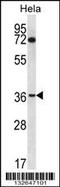 Nucleoporin 35 antibody, 56-703, ProSci, Western Blot image 