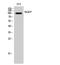 Anoctamin-7 antibody, STJ94478, St John