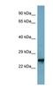 Mitochondrial Ribosomal Protein L48 antibody, NBP1-54676, Novus Biologicals, Western Blot image 