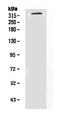 Neurofibromin 1 antibody, A00043-1, Boster Biological Technology, Western Blot image 