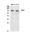 Adhesion G Protein-Coupled Receptor E2 antibody, A30779, Boster Biological Technology, Western Blot image 