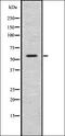 Glucagon Like Peptide 1 Receptor antibody, orb336806, Biorbyt, Western Blot image 