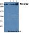 Mediator Complex Subunit 12 antibody, A00828, Boster Biological Technology, Western Blot image 