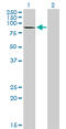 Cadherin 1 antibody, LS-B4297, Lifespan Biosciences, Western Blot image 