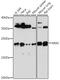 KRAS Proto-Oncogene, GTPase antibody, 14-182, ProSci, Western Blot image 