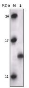 MAPK Activated Protein Kinase 5 antibody, M07923, Boster Biological Technology, Western Blot image 