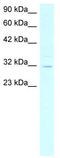 Asialoglycoprotein Receptor 2 antibody, TA334288, Origene, Western Blot image 