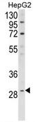 Death Inducer-Obliterator 1 antibody, AP17281PU-N, Origene, Western Blot image 