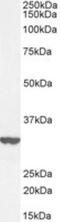 BRI antibody, NBP1-36963, Novus Biologicals, Western Blot image 