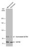 SATB Homeobox 2 antibody, GTX134135, GeneTex, Western Blot image 