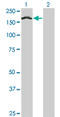 Treacle Ribosome Biogenesis Factor 1 antibody, LS-C198318, Lifespan Biosciences, Western Blot image 