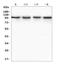 Transient receptor potential cation channel subfamily V member 3 antibody, A03874-1, Boster Biological Technology, Western Blot image 