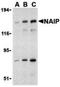 NLR Family Apoptosis Inhibitory Protein antibody, NBP1-77196, Novus Biologicals, Western Blot image 