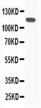 Complement C5 antibody, PA2308-1, Boster Biological Technology, Western Blot image 