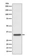 CD74 Molecule antibody, M01340-2, Boster Biological Technology, Western Blot image 