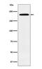 GLI Family Zinc Finger 3 antibody, M01171-1, Boster Biological Technology, Western Blot image 