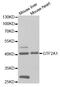 General Transcription Factor IIA Subunit 1 antibody, TA332624, Origene, Western Blot image 