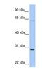 Hypoxanthine Phosphoribosyltransferase 1 antibody, NBP1-52903, Novus Biologicals, Western Blot image 