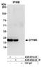 Deoxythymidylate Kinase antibody, A305-652A-M, Bethyl Labs, Immunoprecipitation image 