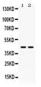Adenosine Deaminase antibody, PB9914, Boster Biological Technology, Western Blot image 