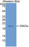 Corin, Serine Peptidase antibody, MBS2026517, MyBioSource, Western Blot image 
