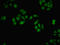 DNA Methyltransferase 3 Beta antibody, LS-C682175, Lifespan Biosciences, Immunofluorescence image 