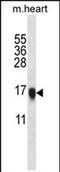 Visinin Like 1 antibody, PA5-71652, Invitrogen Antibodies, Western Blot image 