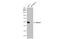 SLC9A3 Regulator 1 antibody, GTX134431, GeneTex, Western Blot image 