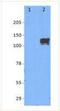 Mitogen-Activated Protein Kinase Kinase Kinase 12 antibody, NBP1-62734, Novus Biologicals, Western Blot image 