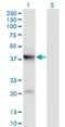 Pantothenate Kinase 3 antibody, MA5-22583, Invitrogen Antibodies, Western Blot image 