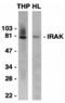 Interleukin 1 Receptor Associated Kinase 1 antibody, MBS150431, MyBioSource, Western Blot image 