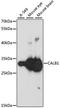 Calbindin 1 antibody, A0802, ABclonal Technology, Western Blot image 