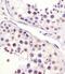 Cell Division Cycle 25C antibody, M01343-2, Boster Biological Technology, Immunohistochemistry paraffin image 