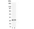 RAB2A, Member RAS Oncogene Family antibody, R31430, NSJ Bioreagents, Western Blot image 