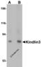 Fermitin Family Member 3 antibody, 4797, ProSci, Western Blot image 