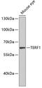 Telomeric Repeat Binding Factor 1 antibody, 13-047, ProSci, Western Blot image 
