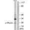 Lysophospholipase 1 antibody, A07249, Boster Biological Technology, Western Blot image 